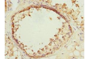 Immunohistochemistry of paraffin-embedded human testis tissue using ABIN7175319 at dilution of 1:100 (VPS4A antibody  (AA 1-120))