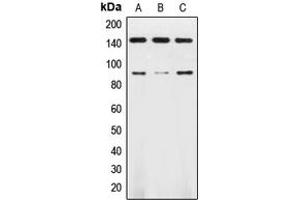 Western blot analysis of TRK B expression in HL60 (A), SKNSH (B), mouse brain (C) whole cell lysates. (TRKB antibody  (Center))