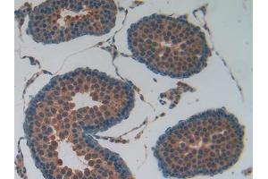 Used in DAB staining on fromalin fixed paraffin- embedded kidney tissue (Lactate Dehydrogenase A antibody  (AA 1-332))