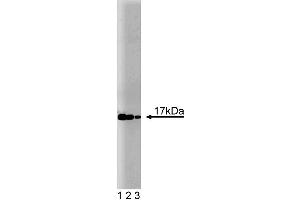 Western blot analysis of UbcH7 on a Jurkat cell lysate (Human T-cell leukemia, ATCC TIB-152). (UBE2L3 antibody  (AA 15-133))