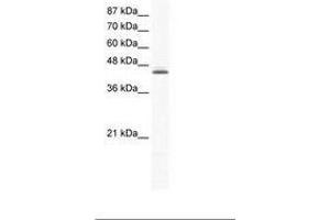 Image no. 1 for anti-ALX Homeobox 4 (ALX4) (C-Term) antibody (ABIN6736020)