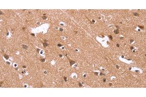 Immunohistochemistry of paraffin-embedded Human brain using HSD17B1 Polyclonal Antibody at dilution of 1:40 (HSD17B1 antibody)