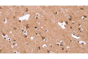 Immunohistochemistry of paraffin-embedded Human brain using HSD17B1 Polyclonal Antibody at dilution of 1:40