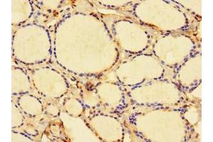 Immunohistochemistry of paraffin-embedded human thyroid tissue using ABIN7157917 at dilution of 1:100 (DBR1 antibody  (AA 1-220))