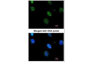 ICC/IF Image Immunofluorescence analysis of paraformaldehyde-fixed HeLa, using MAPKAP Kinase 3 , antibody at 1:200 dilution. (MAPKAP Kinase 3 antibody)