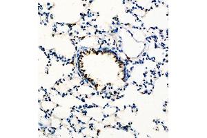 Immunohistochemistry of paraffin embedded rat lung using GP1BA (ABIN7074109) at dilution of 1:600 (300x lens) (CD42b antibody)