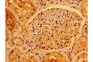 Immunohistochemistry of paraffin-embedded human kidney tissue using ABIN7142936 at dilution of 1:100