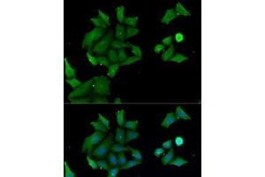 Immunofluorescence analysis of MCF7 cells using HABP2 Polyclonal Antibody (HABP2 antibody)
