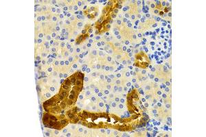 Immunohistochemistry of paraffin-embedded mouse kidney using PVALB Antibody.