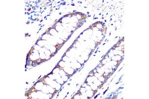 Immunohistochemistry of paraffin-embedded human colon using  Rabbit mAb (ABIN1678801, ABIN3018058, ABIN3018059 and ABIN7101573) at dilution of 1:100 (40x lens). (Angiopoietin 1 antibody)