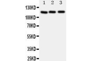 Western Blotting (WB) image for anti-Myosin Phosphatase, Target Subunit 1 (PPP1R12A) (AA 1-17), (N-Term) antibody (ABIN3043106) (PPP1R12A antibody  (N-Term))
