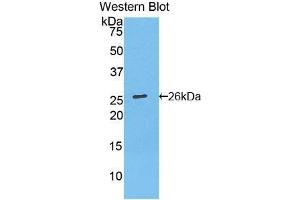 Western blot analysis of recombinant Mouse Bcl2. (Bcl-2 antibody  (AA 2-208))