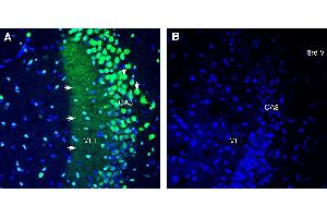 anti-Mucolipin 1 (MCOLN1) (AA 6-19), (Intracellular) antibody