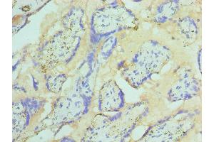 Immunohistochemistry of paraffin-embedded human placenta tissue using ABIN7171018 at dilution of 1:100 (ST14 antibody  (AA 566-855))