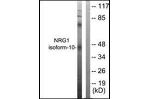 Western blot analysis of extracts from SKOV3 cells, using NRG1 isoform-10 Antibody. (Neuregulin 1 antibody  (Isoform 10, N-Term))