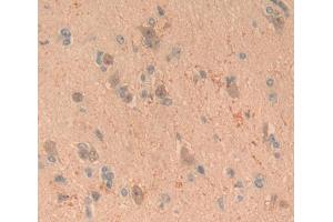 Used in DAB staining on fromalin fixed paraffin- embedded brain tissue (CRABP1 antibody  (AA 2-137))