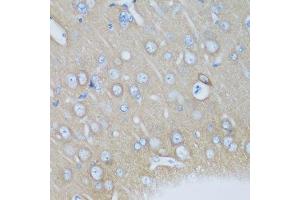 Immunohistochemistry of paraffin-embedded mouse brain using VSNL1 antibody. (VSNL1 antibody  (AA 1-191))