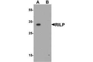 Western blot analysis of RILP in A20 cell lysate with RILP antibody at 1 ug/mL.