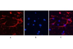 anti-Glial Fibrillary Acidic Protein (GFAP) antibody