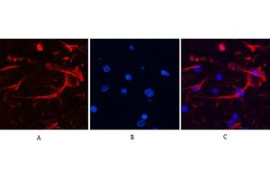 Immunofluorescence analysis of rat brain tissue. (GFAP antibody)