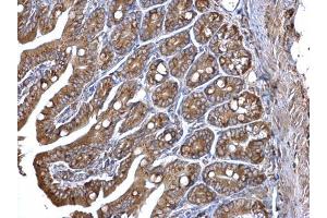Immunohistochemistry (IHC) image for anti-Protein Disulfide Isomerase Family A, Member 3 (PDIA3) (C-Term) antibody (ABIN2854699)