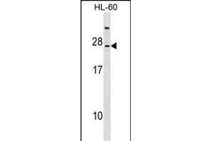 LY96 Antibody (C-term) (ABIN1536634 and ABIN2849030) western blot analysis in HL-60 cell line lysates (35 μg/lane). (LY96 antibody  (C-Term))