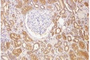 Immunohistochemical staining of human kidney using AP30128PU-N Bcl-2 antibody at 2 μg/ml. (Bcl-2 antibody  (N-Term))