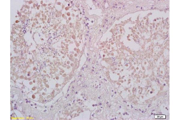AURKAIP1 antibody  (AA 101-199)
