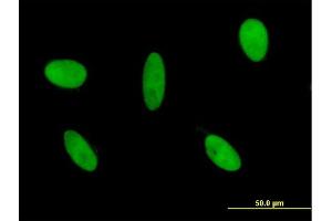 Immunofluorescence of monoclonal antibody to GLI3 on HeLa cell.
