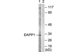 Western blot analysis of extracts from 293 cells, treated with Insulin 0. (DAPP1 antibody  (AA 105-154))