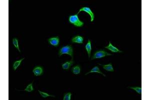 Immunofluorescence staining of A549 cells with ABIN7150574 at 1:133, counter-stained with DAPI. (DOK5 antibody  (AA 1-198))