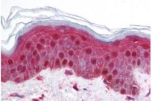 Human Skin (formalin-fixed, paraffin-embedded) stained with BRD2 antibody ABIN214728 at 5 ug/ml followed by biotinylated goat anti-rabbit IgG secondary antibody ABIN481713, alkaline phosphatase-streptavidin and chromogen. (BRD2 antibody  (AA 524-573))