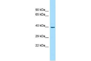 WB Suggested Anti-ANKS1B Antibody Titration: 1. (ANKS1B antibody  (C-Term))