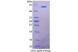 SDS-PAGE (SDS) image for Secreted phosphoprotein 1 (SPP1) (AA 17-287) protein (His tag,GST tag) (ABIN2123434)