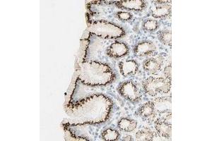 Immunohistochemical staining of human stomach with B4GALNT3 polyclonal antibody  shows strong cytoplasmic positivity in glandular cells. (B4GALNT3 antibody)