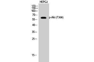 Western Blot analysis of HepG2 cells using Phospho-AKT1 (Thr308) Polyclonal Antibody at dilution of 1:1000 (AKT1 antibody  (pThr308))