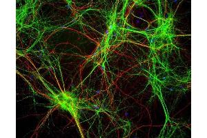 Mixed neuron/glia cultures stained with ABIN1580434 (green) and also rabbit antibody of neurofilament NF-H RPCA-NF-H (red). (MAP2 antibody)