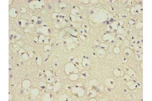 Immunohistochemistry of paraffin-embedded human brain tissue using ABIN7145408 at dilution of 1:100 (B3GNT1 antibody  (AA 161-415))
