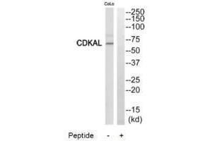 Western blot analysis of extracts from COLO205 cells, using CDKAL antibody.