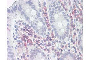 PSME1 antibody  (AA 72-121)