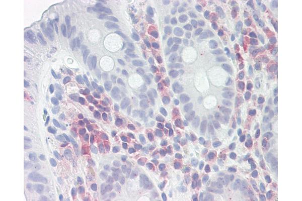 PSME1 antibody  (AA 72-121)