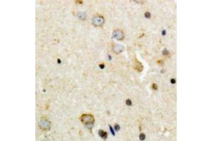Immunohistochemistry (IHC) image for anti-Tyrosine Hydroxylase (TH) (N-Term), (pSer8) antibody (ABIN7302918)