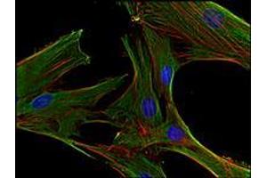 Immunofluorescence (IF) image for anti-Clathrin Heavy Chain (CLTC) (Heavy Chain) antibody (ABIN238388) (Clathrin Heavy Chain (CLTC) (Heavy Chain) antibody)