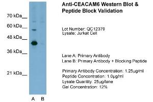 Host:  Rabbit  Target Name:  CEACAM6  Sample Type:  Jurkat  Lane A:  Primary Antibody  Lane B:  Primary Antibody + Blocking Peptide  Primary Antibody Concentration:  1.