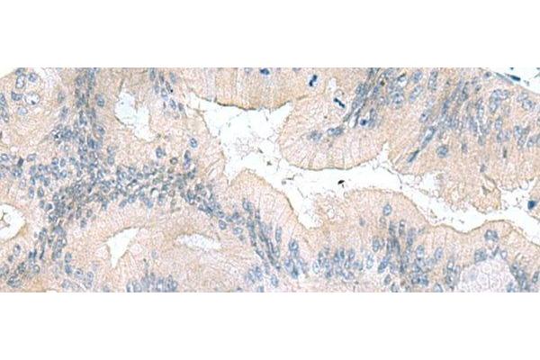UBE2F antibody
