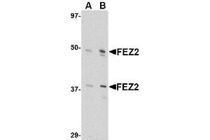 Western blot analysis of FEZ2 in 3T3 cell lysate with AP30335PU-N FEZ2 antibody at (A) 0. (FEZ2 antibody  (Center))