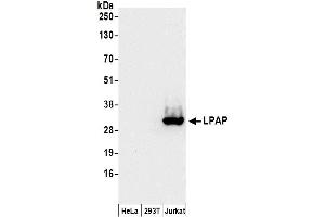Western Blotting (WB) image for anti-Protein tyrosine Phosphatase, Receptor Type, C Polypeptide-Associated Protein (PTPRCAP) (AA 156-206) antibody (ABIN7450421)