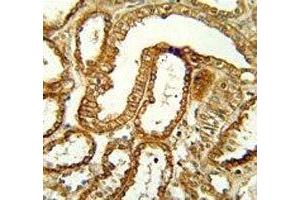 CCR1 antibody immunohistochemistry analysis in formalin fixed and paraffin embedded human kidney tissue. (CCR1 antibody  (AA 1-30))