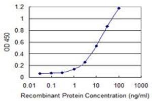 Detection limit for recombinant GST tagged ETNK1 is 0. (Ethanolamine Kinase 1 antibody  (AA 133-228))