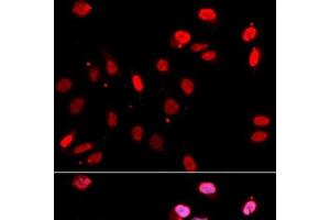 Immunofluorescence analysis of U2OS cells using RAD18 Polyclonal Antibody (RAD18 antibody)